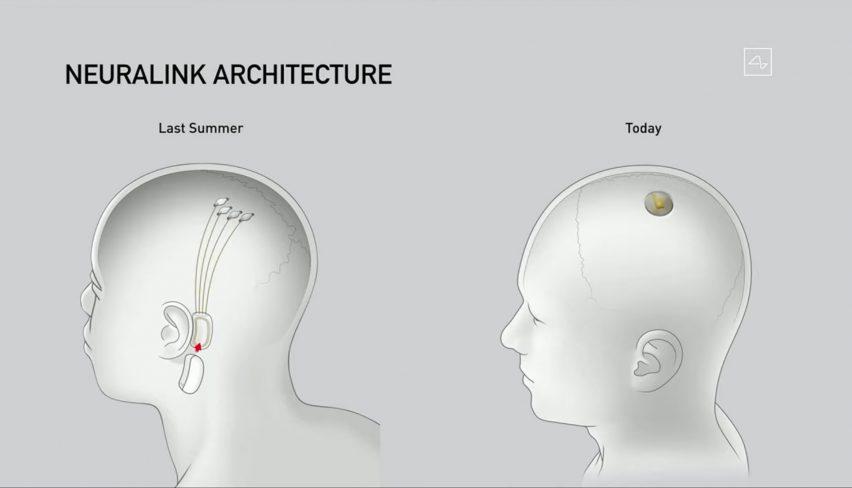 Elon Musk'ın Şirketi Neuralink İzin Aldı: İnsan Deneylerine Başlıyor