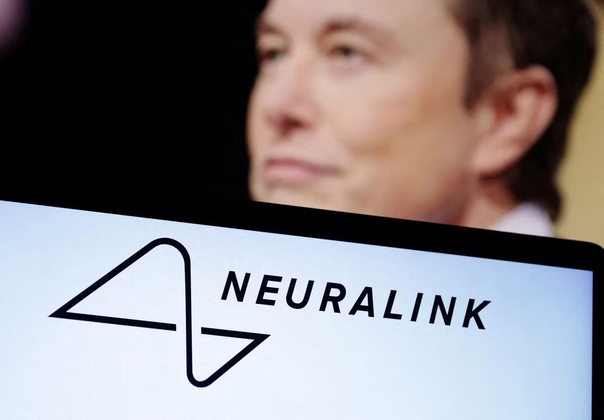 Elon Musk Neuralink İçin İzin Aldı: İnsan Deneyleri Başlıyor