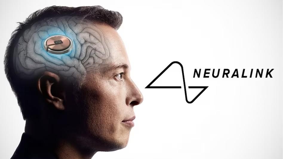 Neuralink, İlk İnsan İmplantını Gerçekleştirdi