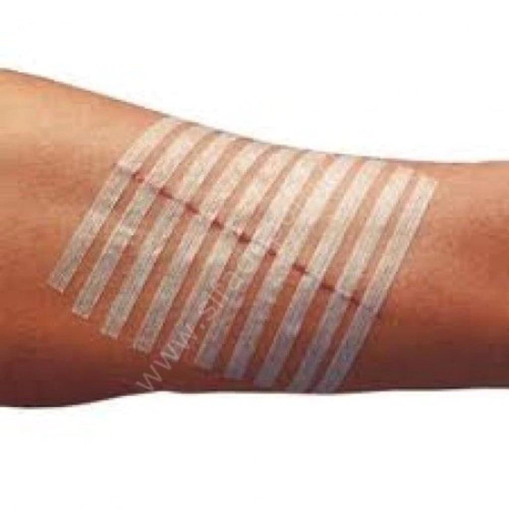 Smart Band-Aid Resonates in the Healthcare Industry