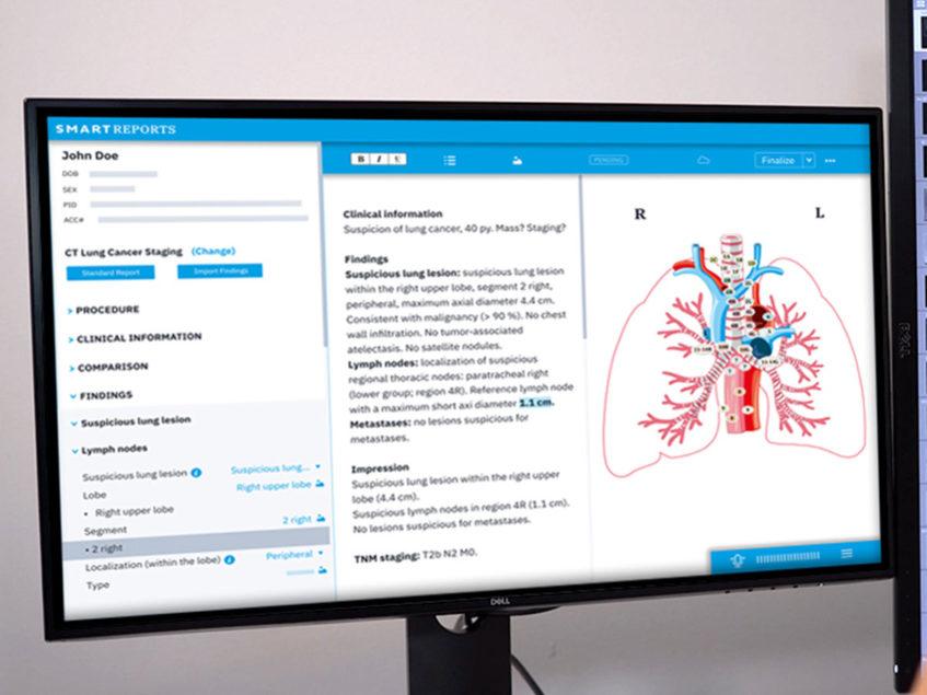 Smart Reporting, 23 Milyon Euro Yatırım Aldı